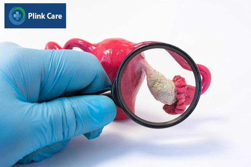 không thực hiện iui khi bị suy buồng trứng