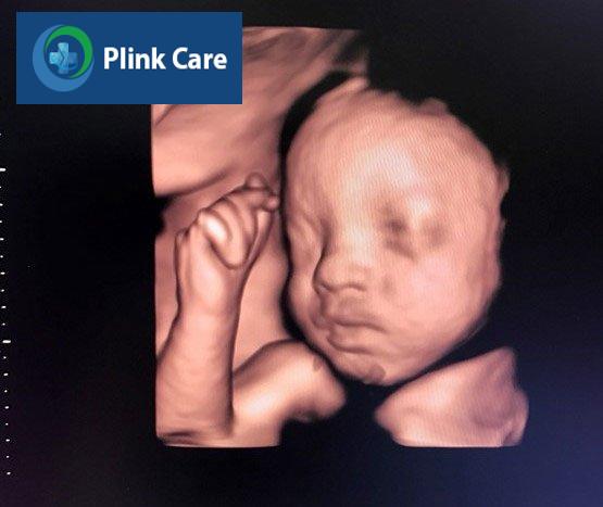 hình ảnh thai nhi khi siêu âm 4d