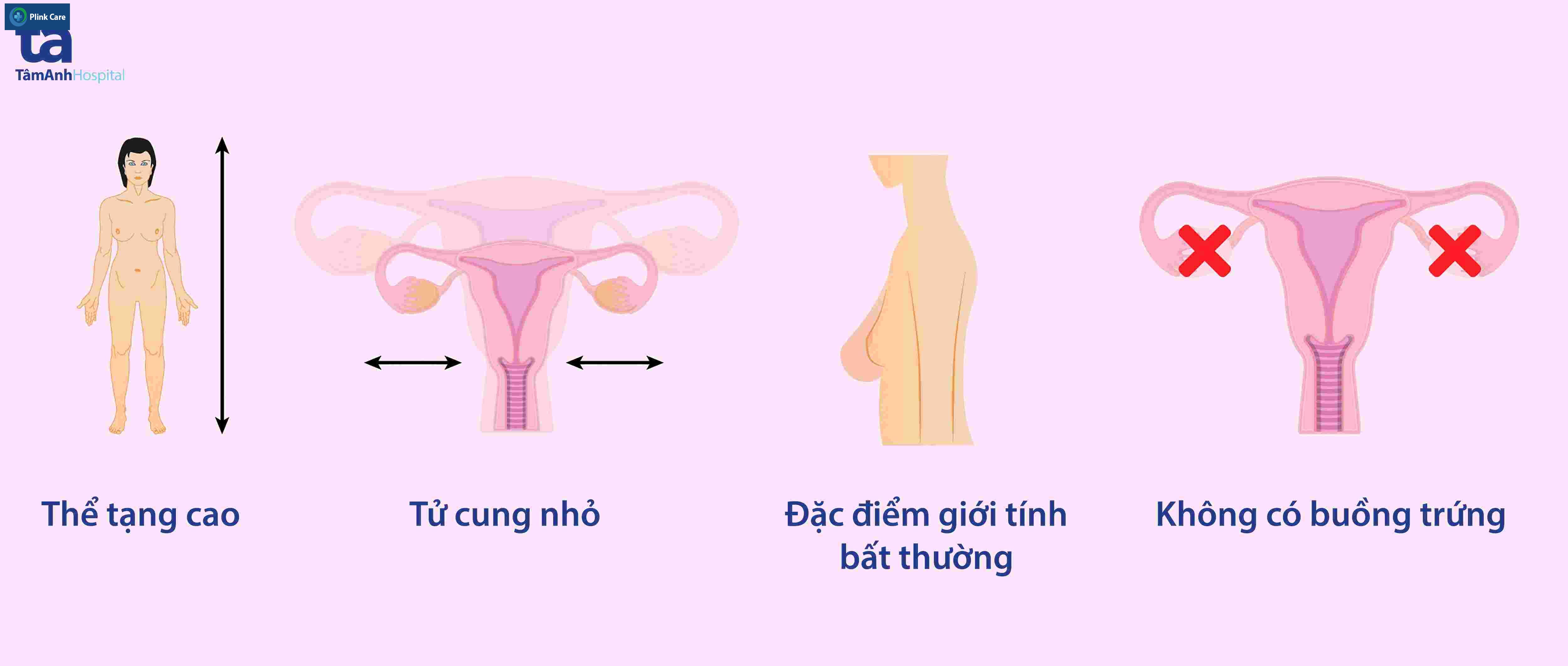 Dấu hiệu hội chứng swyer