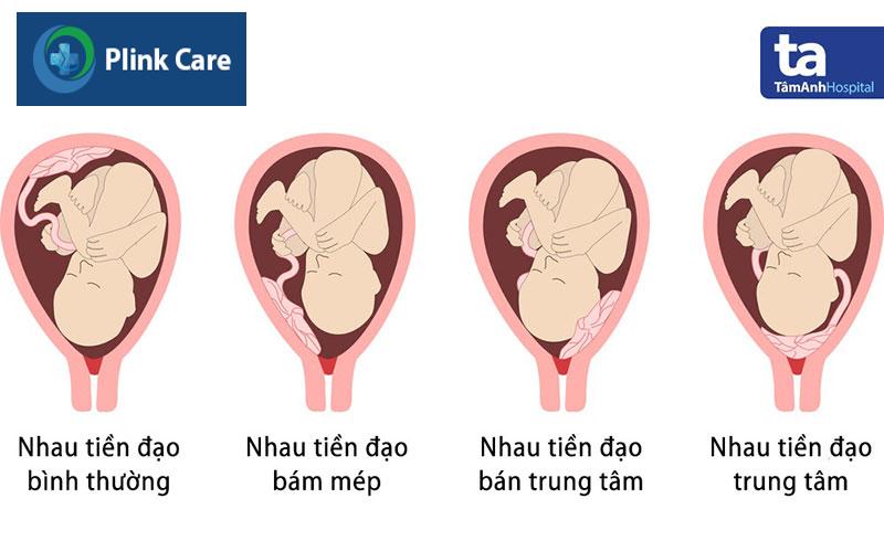Nhau tiền đạo