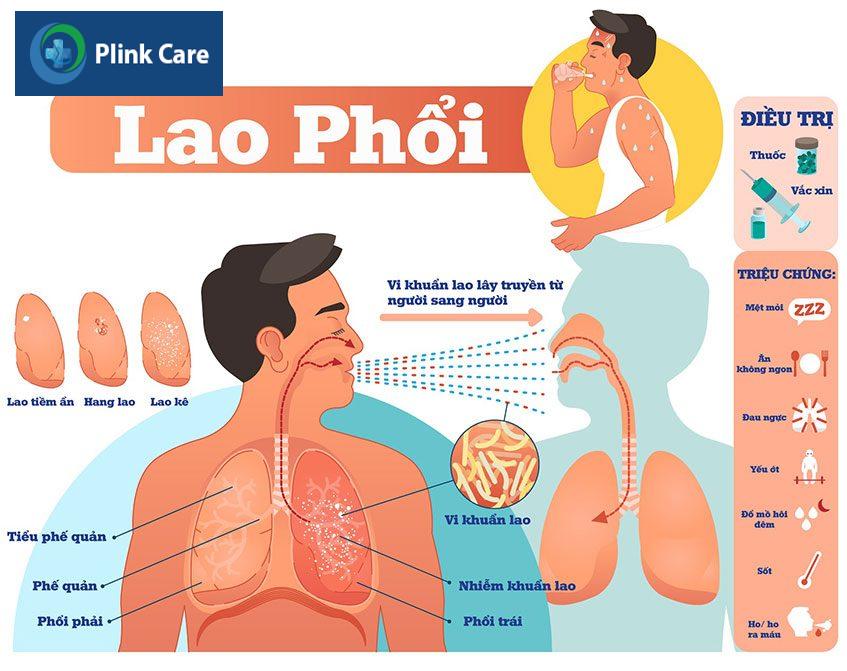 Bệnh ho lao phổi