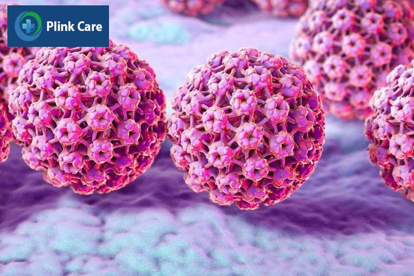 virus-hpv-nguyên-nhân-gây-khối-u-cổ-tử-cung