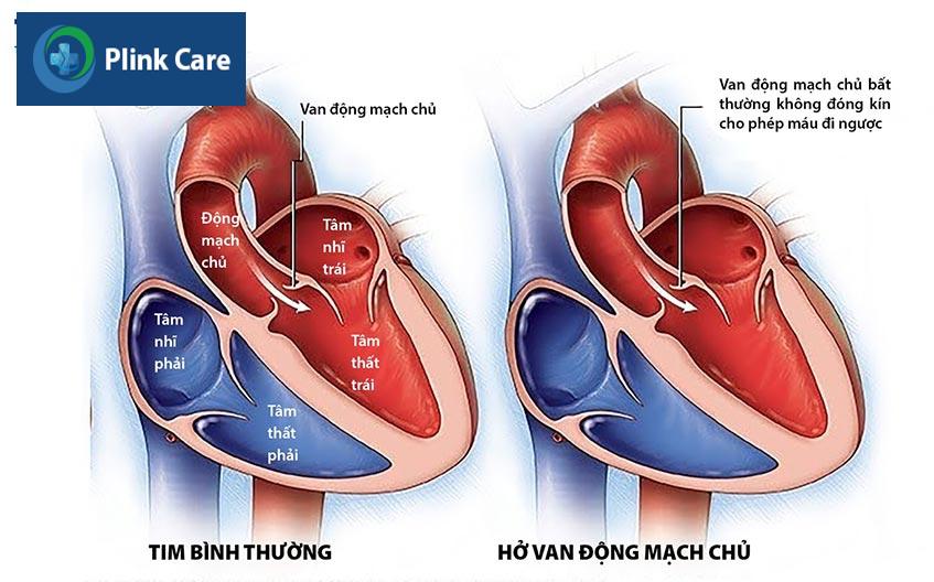 ho van dong mach chu
