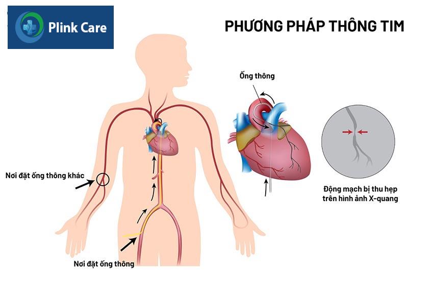 phuong phap thong tim