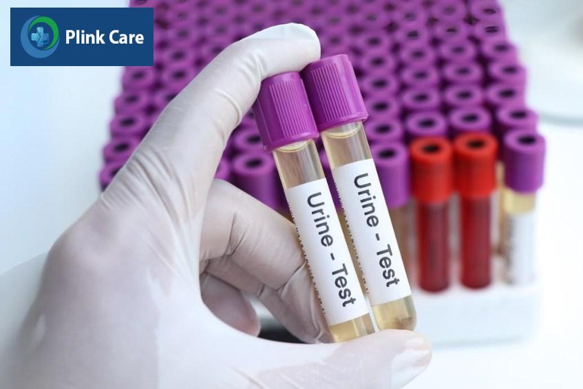 chẩn đoán sỏi tiết niệu