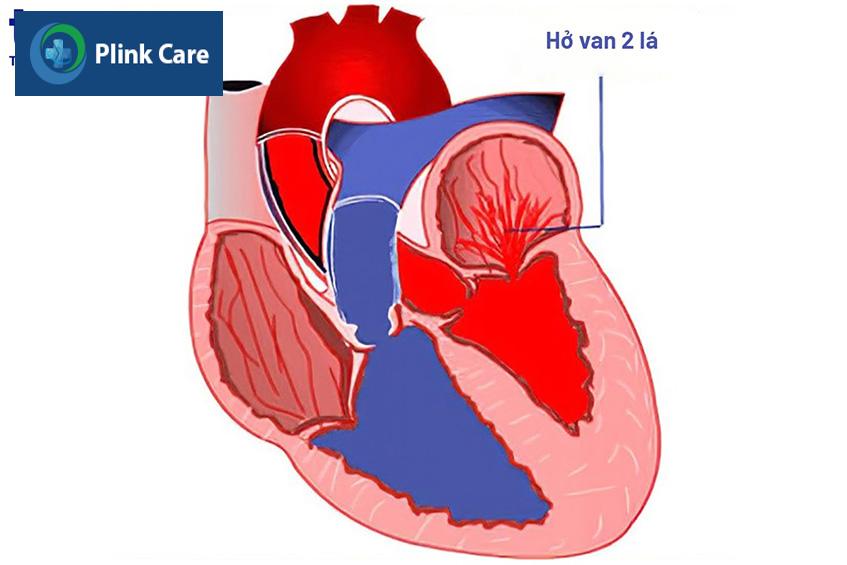 ho-van-2-la-infographic
