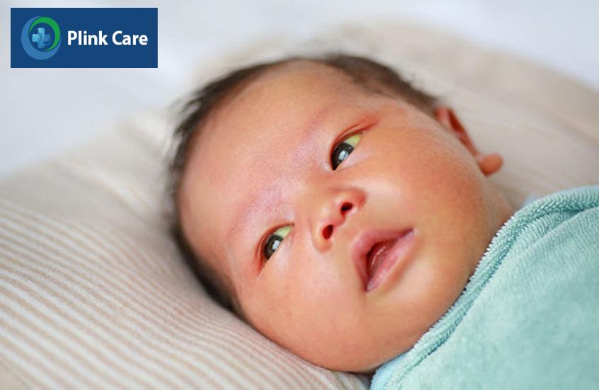 Mặt và củng mạc