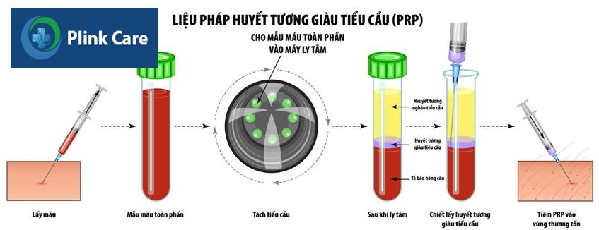 Quy trình sử dụng