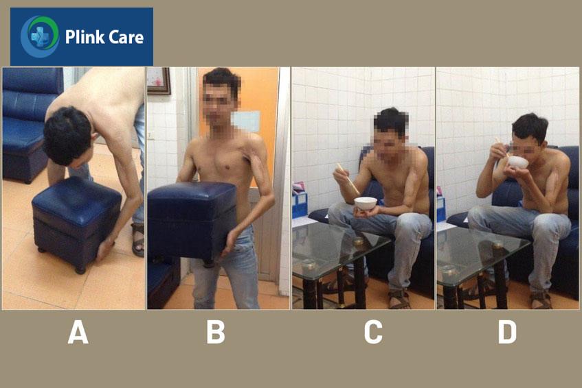 bệnh nhân nguyễn duy kh