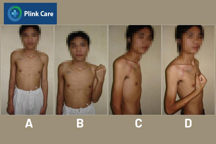bệnh nhân trần văn q