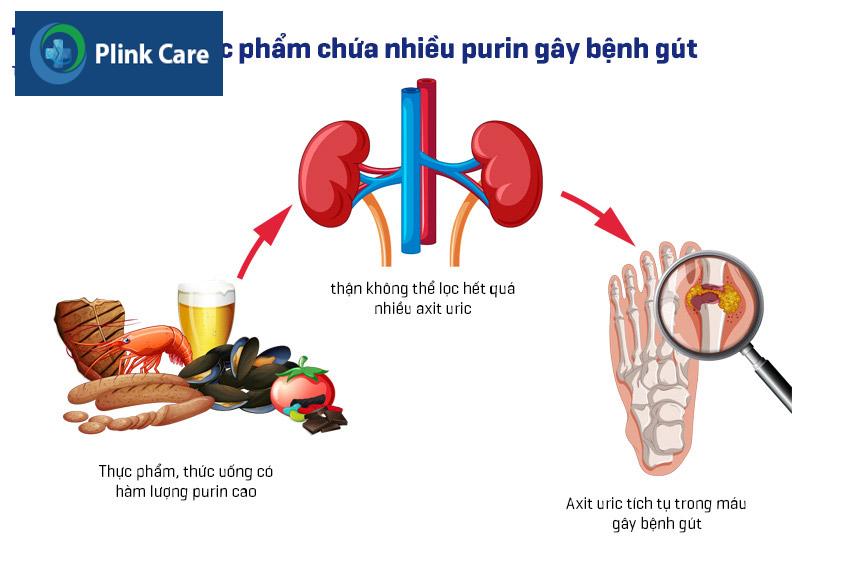 thực phẩm chứa nhiều purin