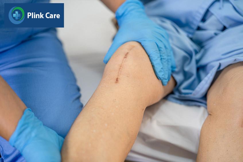 cách điều trị bệnh thoái hóa khớp