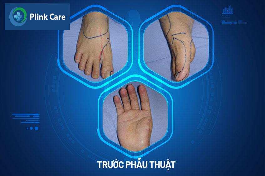 hinh anh truoc phau thuat