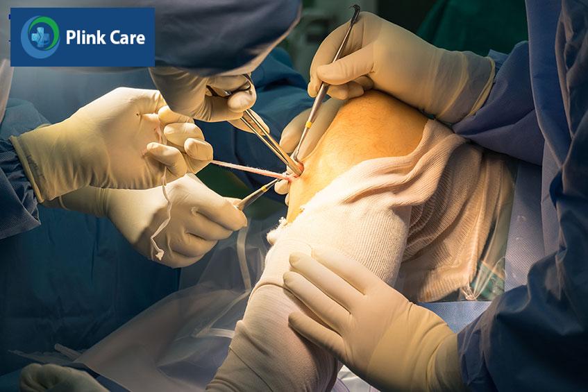 Phẫu thuật nối dây chằng chéo trước