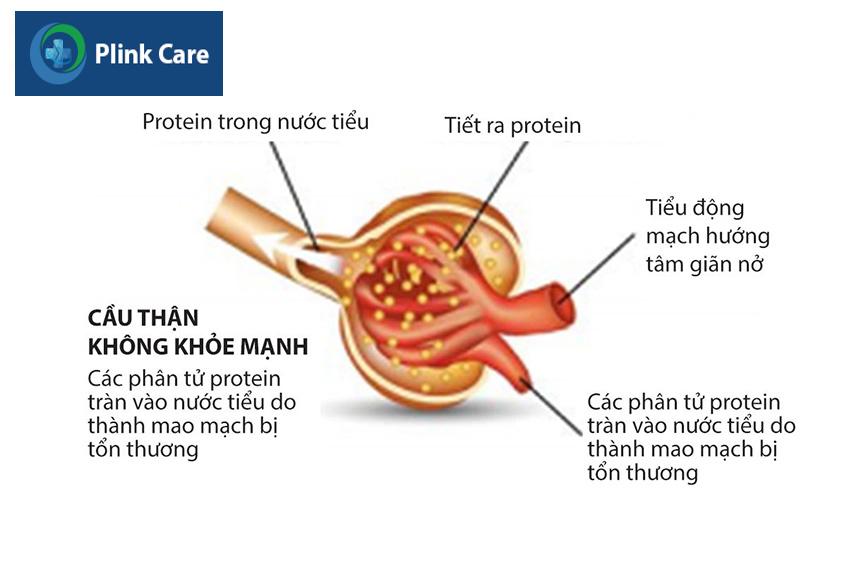 Hình ảnh cầu thận