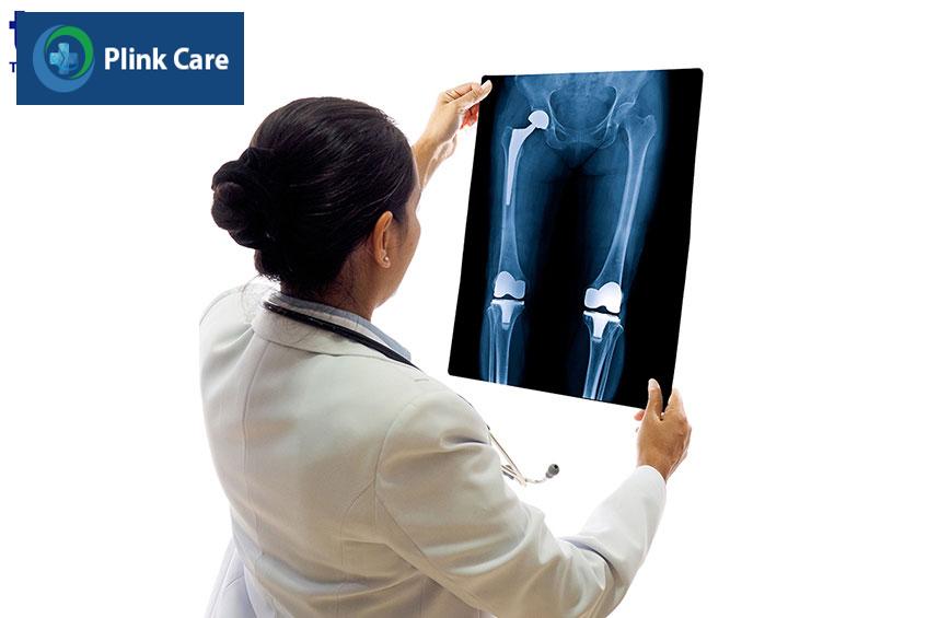 biến chứng sau phẫu thuật thay khớp háng