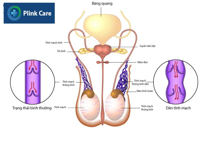 cấu tạo của tinh hoàn