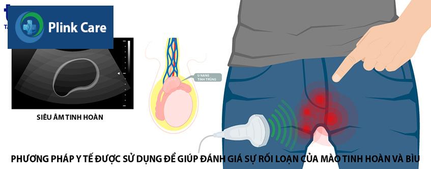 đánh giá rối loạn mào tinh