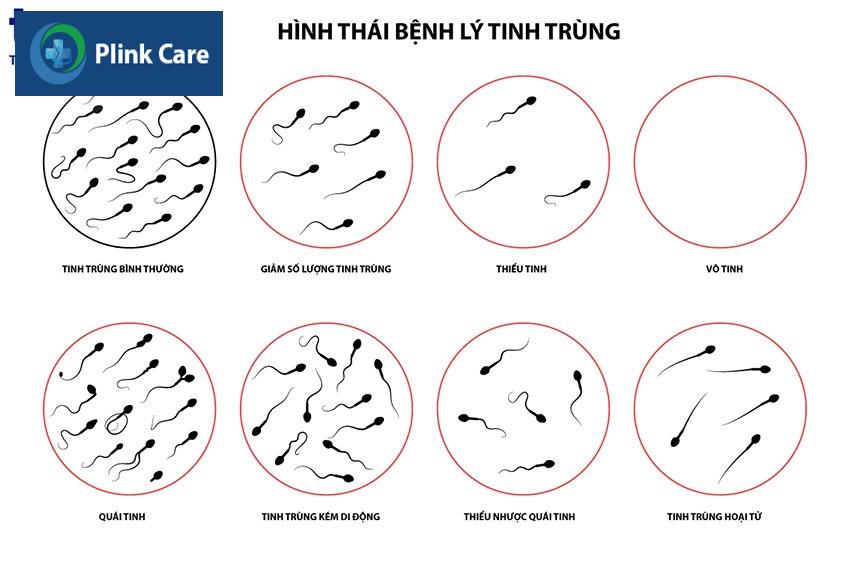 hình thái bệnh lý tinh trùng