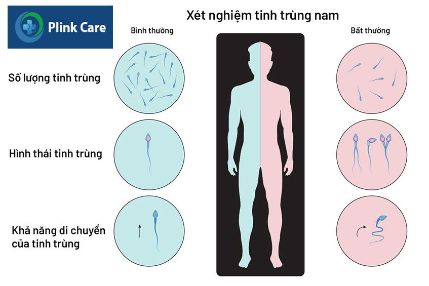 Xét nghiệm tinh trùng nam