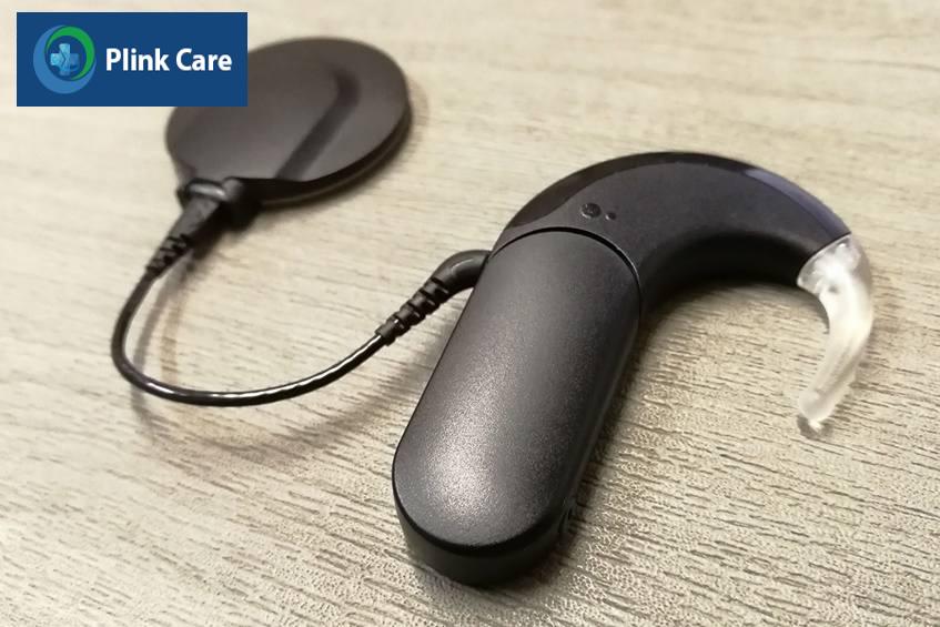 điện cực ốc tai giá bao nhiêu