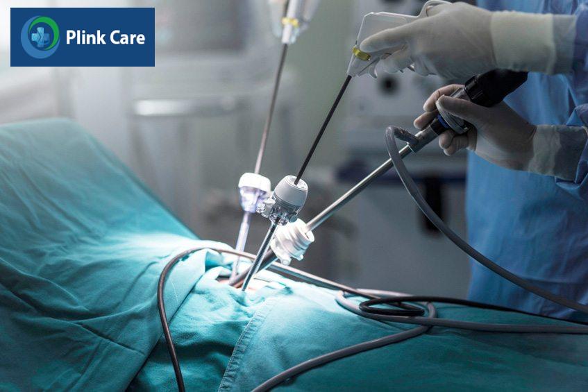 Phẫu thuật cắt bỏ thực quản nội soi