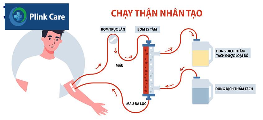 quy trình chạy thận nhân tạo