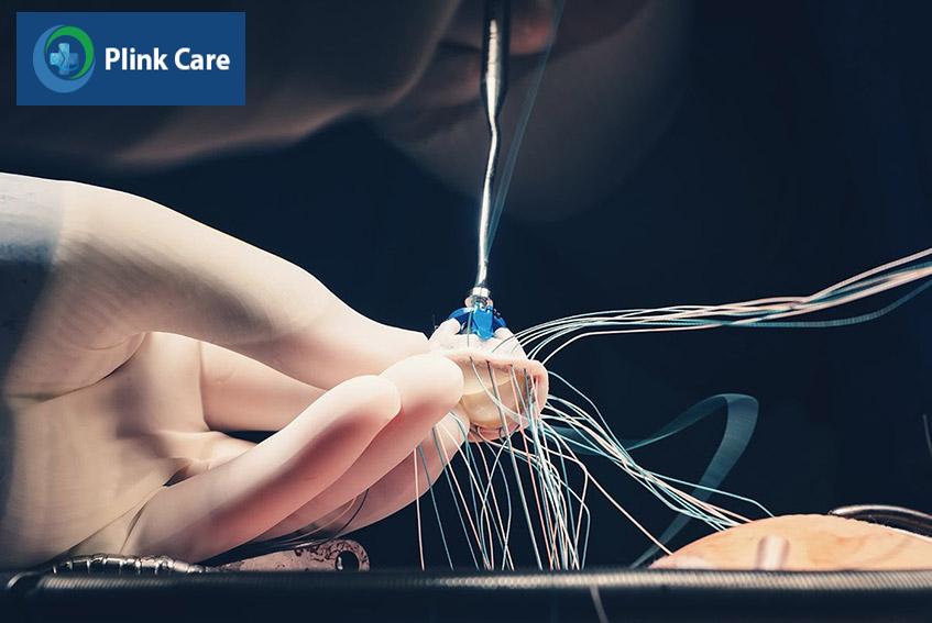áp dụng biện pháp thay van tim