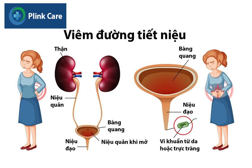 bàng quang và thận