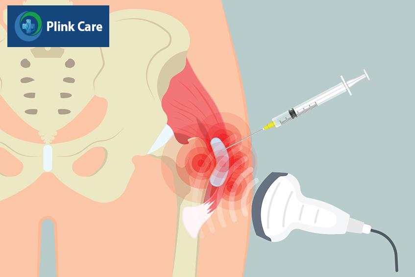 điều trị viêm khớp háng bằng nội khoa