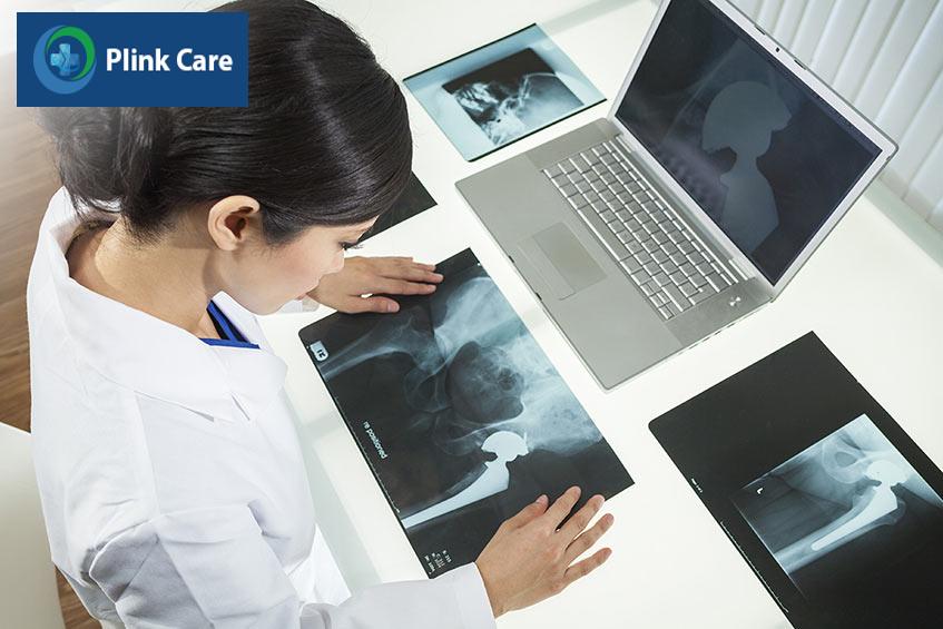 lưu ý sau phẫu thuật khớp háng