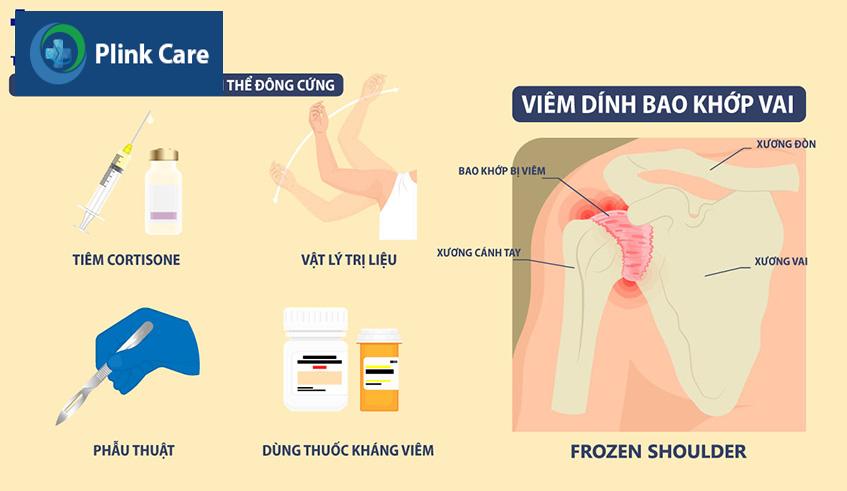 phương pháp điều trị khớp vai bị thoái hóa