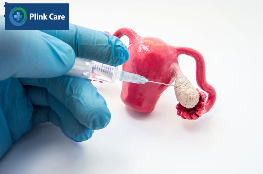 quy trình quan trọng của ivf và iui