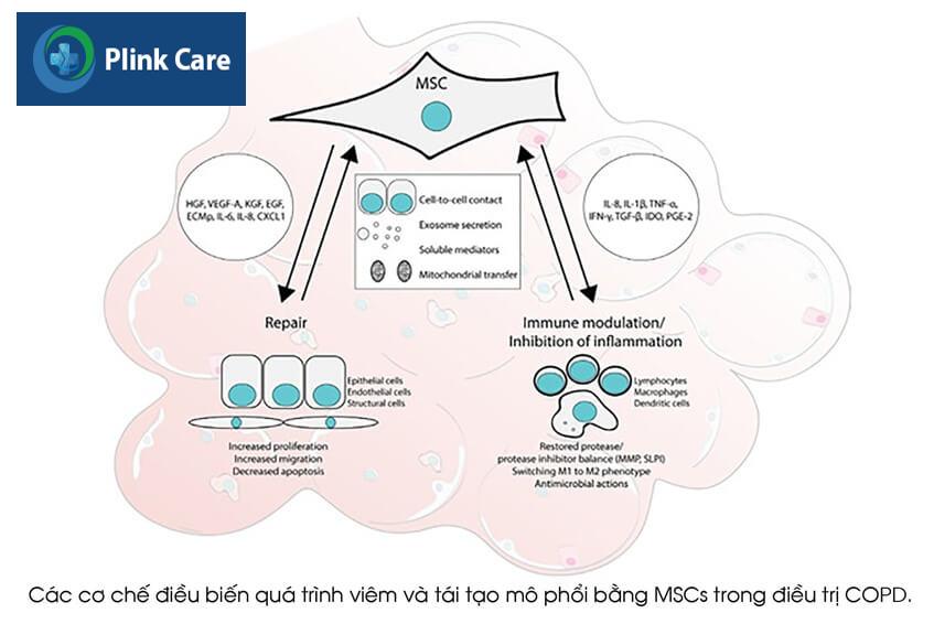 điều trị copd bằng tế bào gốc mscs