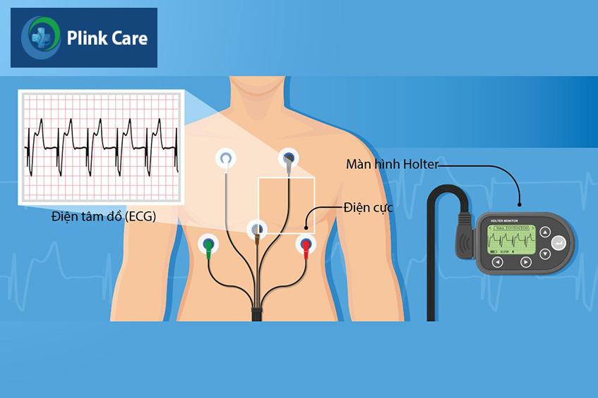 ECG phát hiện các vấn đề về tim mạch
