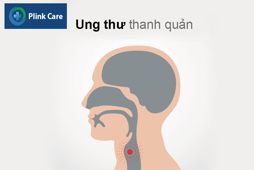 ung thu day thanh quan