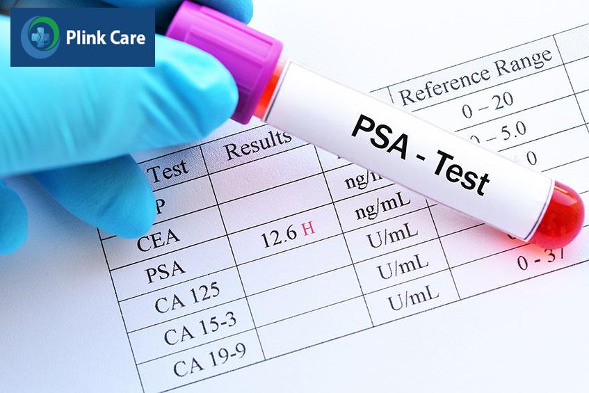 vì sao cần xét nghiệm psa?