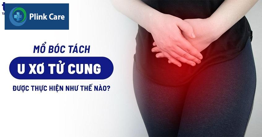 mổ bóc tách u xơ tử cung là gì