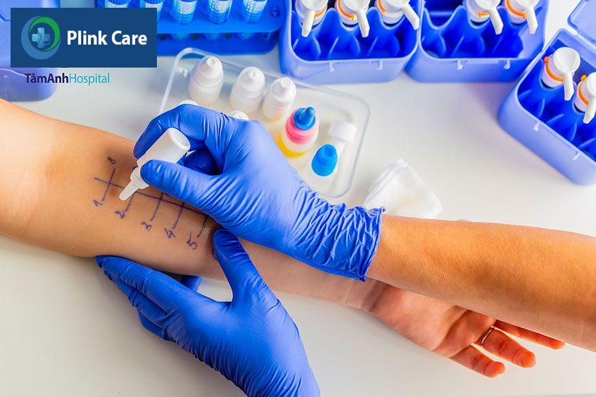 test lẩy da xét nghiệm dị ứng
