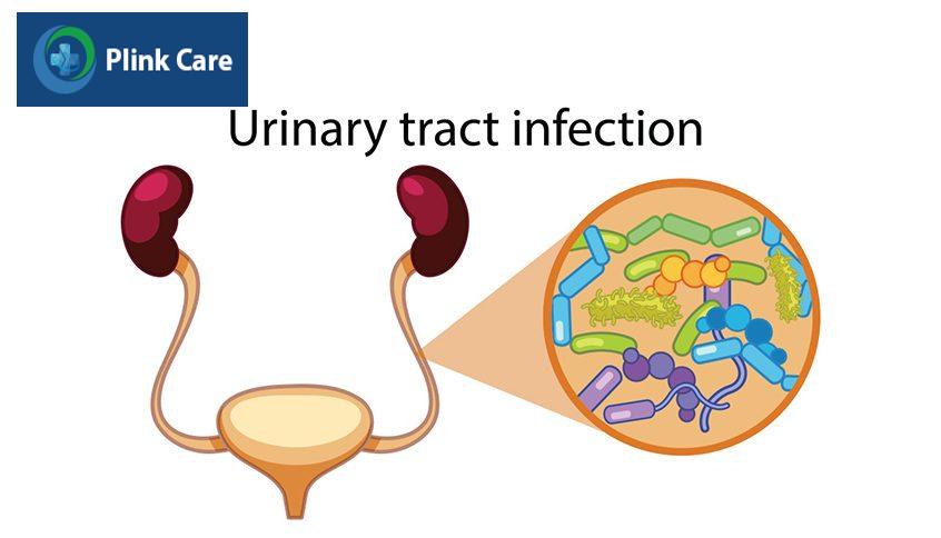 vi khuẩn e.coli