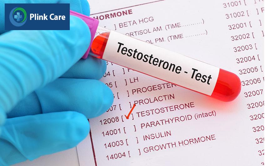 xét nghiệm Testosterone