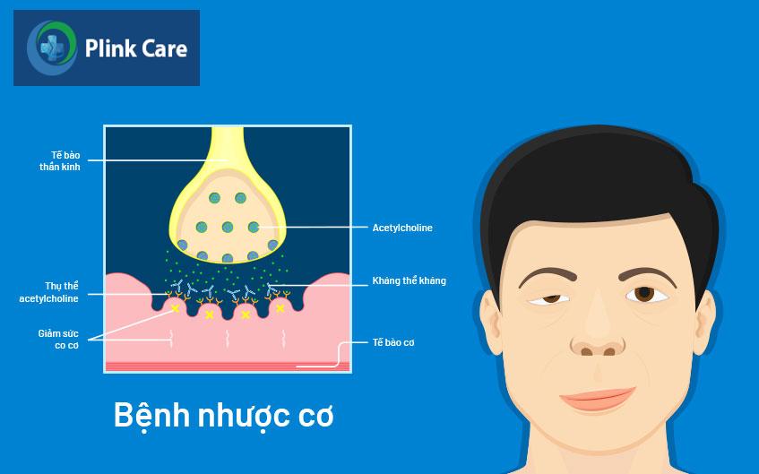 nhược cơ là gì