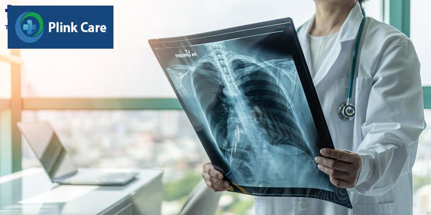 chụp xquang phổi cho bệnh nhân covid