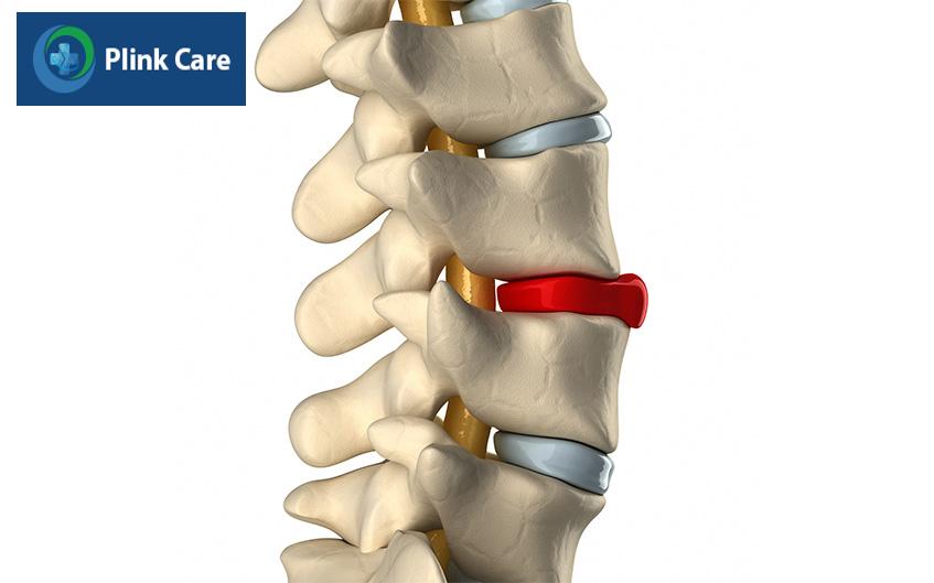đau lưng do thoát vị đĩa đệm