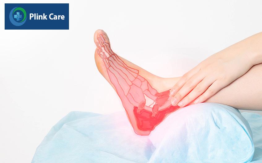 điều trị viêm gân gót chân achilles