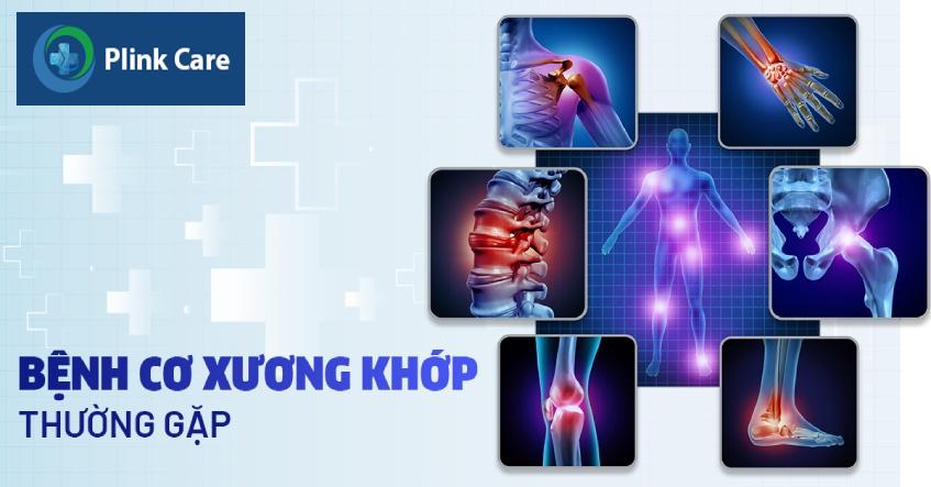 các bệnh cơ xương khớp