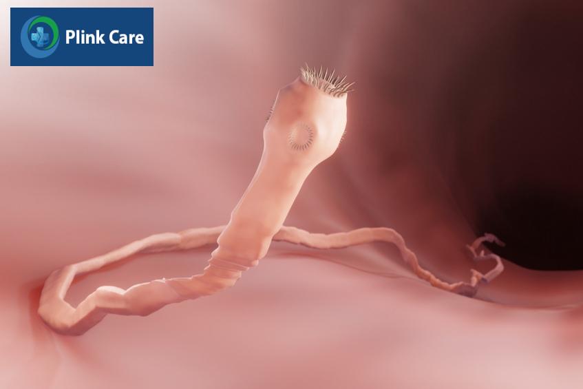 đặc điểm sinh học sán dây lợn