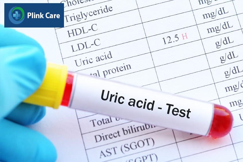 theo dõi điều trị bệnh gout