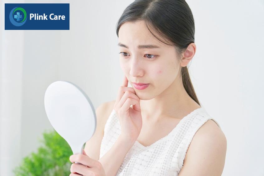 được chỉ định điều trị mụn trứng cá nặng