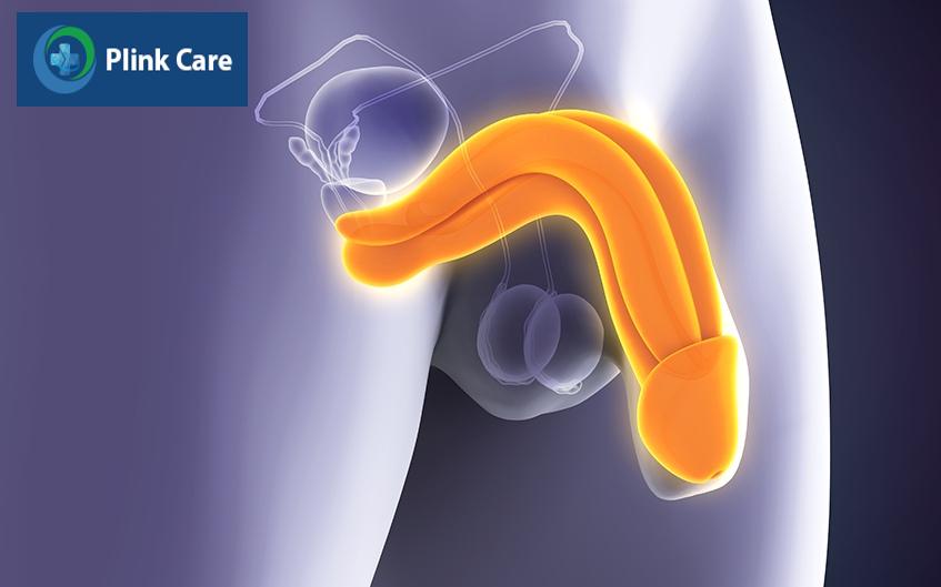 sui mào gà giai đoạn đầu có nguy hiểm không